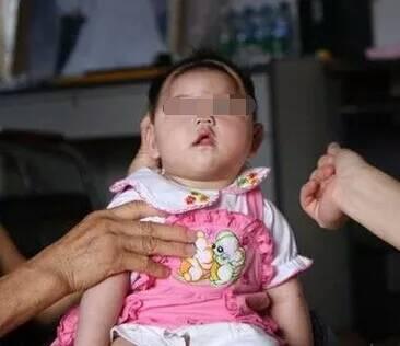 母親在3個月大的嬰兒枕頭下放這東西，半年後孩子被診斷患上腦癱