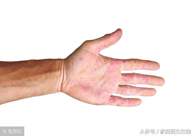 肝臟不好，這四個地方容易發生變化，可惜很少人察覺到
