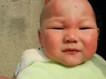 蚊子為什麼總是繞開「娘」，而去攻擊「娃」！