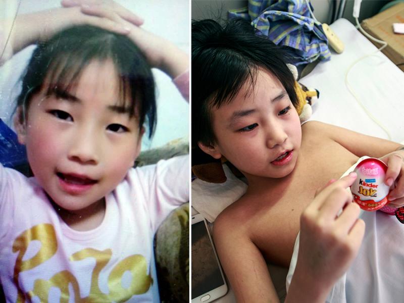 女孩遇車禍 慘遭斷腿成美人魚 殘疾父親圓謊救女