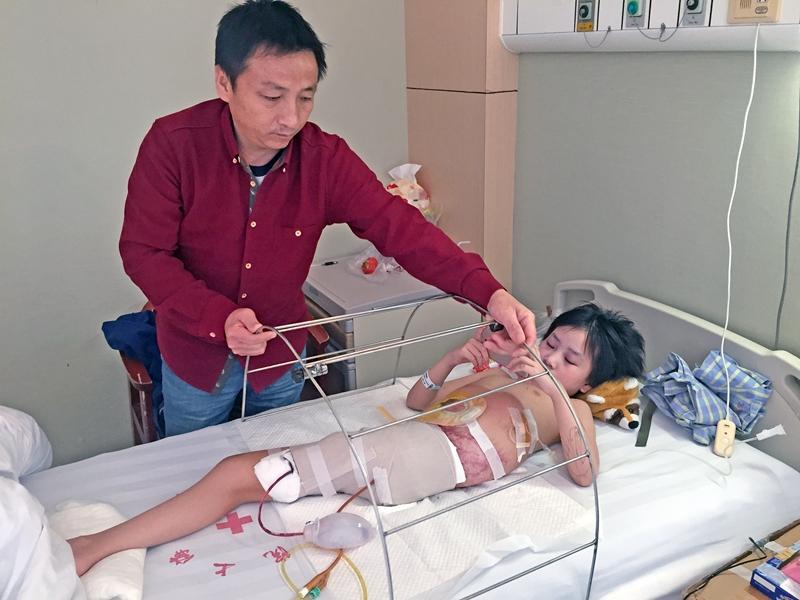 女孩遇車禍 慘遭斷腿成美人魚 殘疾父親圓謊救女
