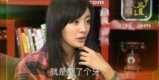 【戴完牙套後大變臉！】這明星沒矯正牙齒之前原來長這樣！網友：牙齒真的很重要啊！