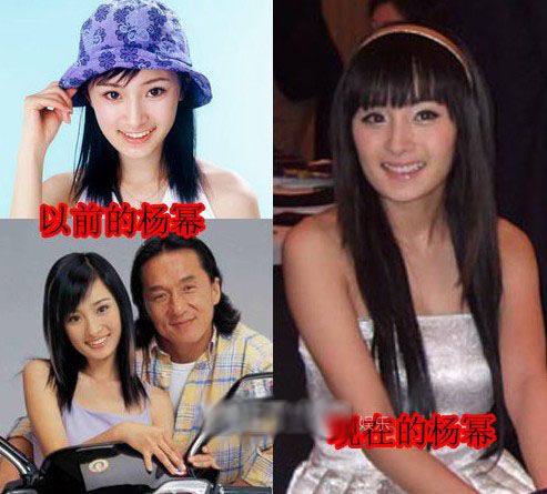 【戴完牙套後大變臉！】這明星沒矯正牙齒之前原來長這樣！網友：牙齒真的很重要啊！