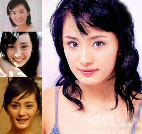 【戴完牙套後大變臉！】這明星沒矯正牙齒之前原來長這樣！網友：牙齒真的很重要啊！