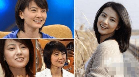 【戴完牙套後大變臉！】這明星沒矯正牙齒之前原來長這樣！網友：牙齒真的很重要啊！