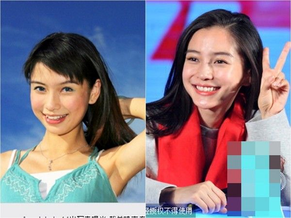 【戴完牙套後大變臉！】這明星沒矯正牙齒之前原來長這樣！網友：牙齒真的很重要啊！