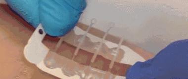科學家發明「皮膚拉鏈」，只要把傷口拉鏈拉上就好，超血腥畫面讓人懷疑，但網友驚呼超神奇 