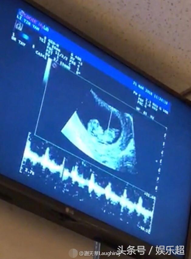 古惑仔都重女輕男？陳小春想要女兒，「大天二」逼老婆二胎生女！