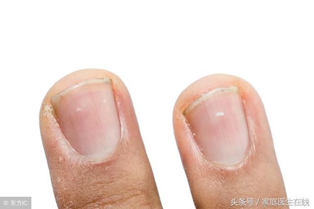 腎不好的人，手上會出現4個「警報」，希望你能早點看到！