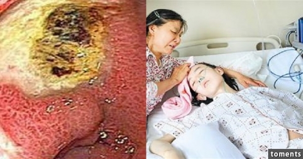 一家三人沒有不良嗜好，但全得了癌症！醫生分析後發現原因竟然是…很多台灣人都這麼做，一定要注意！