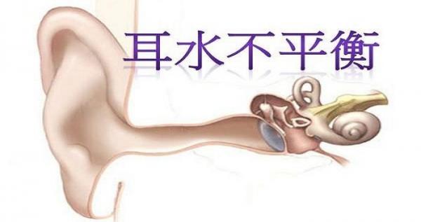 秘方：一碗水治療耳水不平衡(暈眩症)！分享功德無量~