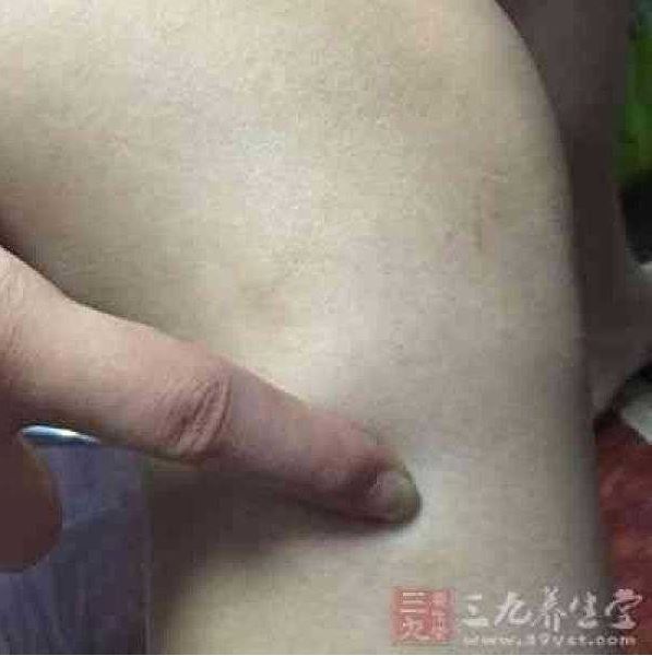 穴位按摩到底能治哪些疾病？便秘時，可試著按壓「這個地方」… 