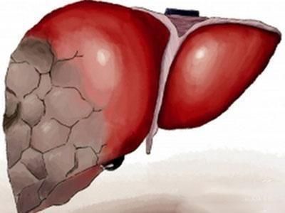 8歲寶寶查出肝癌，醫生嘆息:這種調料最好一口都不碰!！