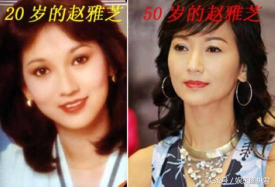 63歲趙雅芝與兒子合照似情侶，『 但網友卻紛紛注意到她的腳』… 