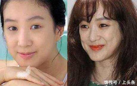 最不該整容的五個女星：蕭薔令人最可惜，最後一個整不整都一樣 