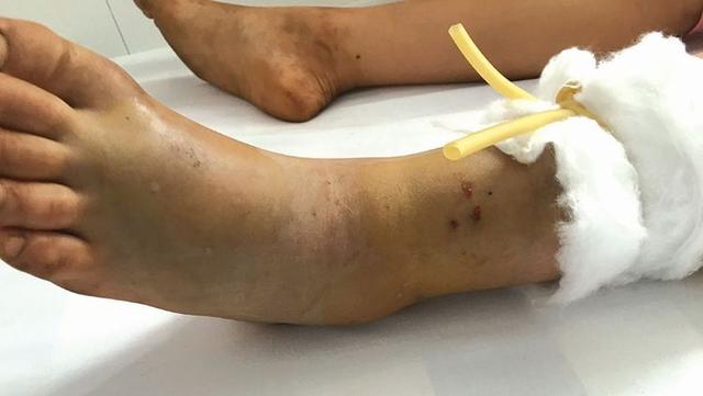 8歲女童中毒身亡，火化前發生的事，把父母嚇出一身冷汗