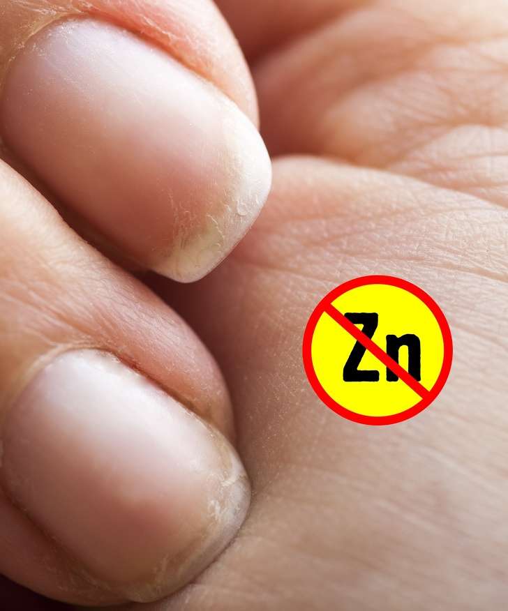 看手就可以發現的「7個健康問題」　手掌麻木太久一定要馬上看醫生 