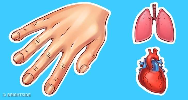 看手就可以發現的「7個健康問題」　手掌麻木太久一定要馬上看醫生 