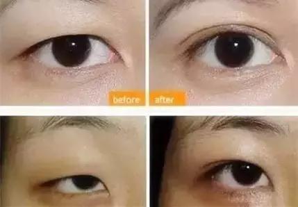 不花一分錢，就能做一次全面健康體檢！快來一起照著做吧！ 