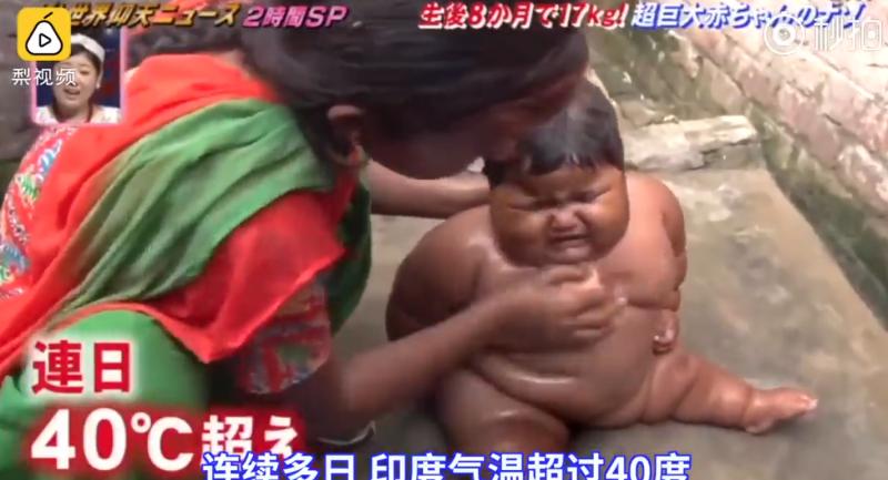 真實版米其林寶寶！1歲嬰兒「一天喝23次奶」體重破20公斤　醫生檢查才發現「問題出在爸媽身上」 