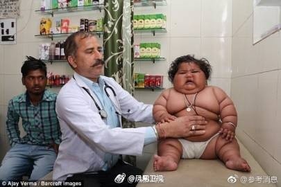 真實版米其林寶寶！1歲嬰兒「一天喝23次奶」體重破20公斤　醫生檢查才發現「問題出在爸媽身上」 