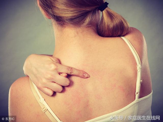 蕁麻疹是由什麼引起的？這4個「禍首」，哪個都別小看 