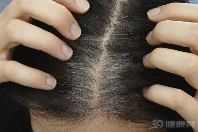 少白頭的4個「理由」，有白髮的人趕緊看看