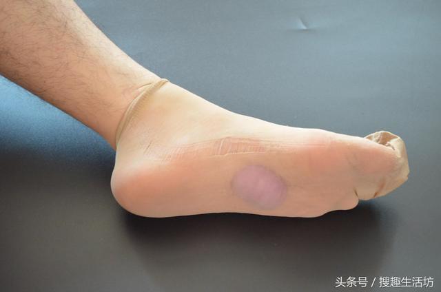 洋蔥切1片貼在腳心，解決了家家戶戶的一大難題，簡單又實用 