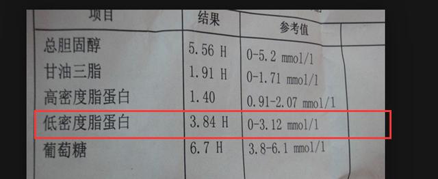 6個警報，提示腦血管又髒又堵，常喝1種水，沖凈血管阻止來腦梗