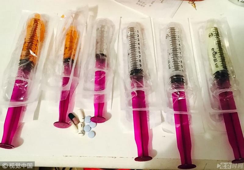 英國23歲女子，自出生起腸子外露，每天靠注射藥品活命！