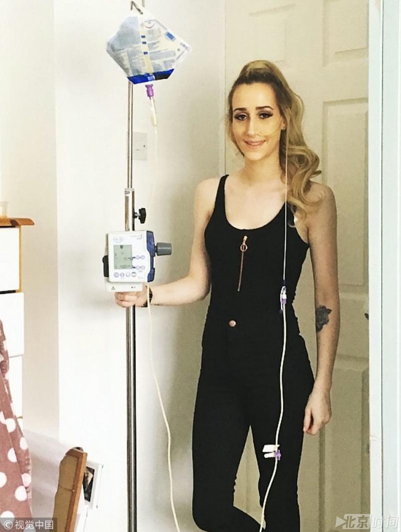 英國23歲女子，自出生起腸子外露，每天靠注射藥品活命！