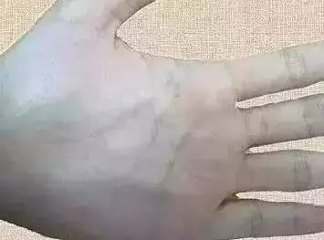 手上青筋越多，說明越……尤其是女性一定要看！