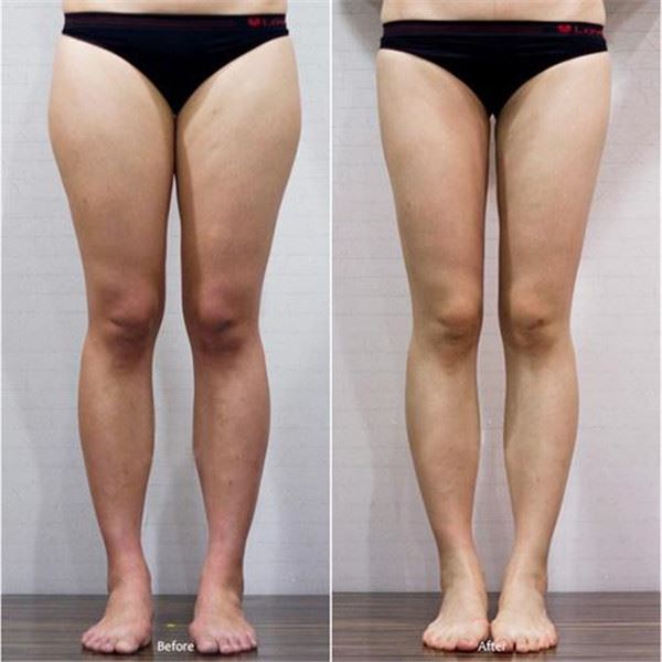 誰說「肌肉腿、大象腿」沒有救？這套「10天瘦腿操」包你瘦回小蜜腿！堅持下去...效果一定看得見！ 