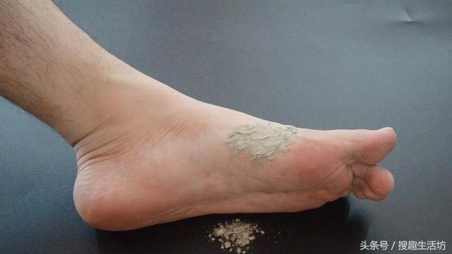 蚊香點完，蚊香灰別再倒掉了，這3大妙用，能幫你省下不少的麻煩