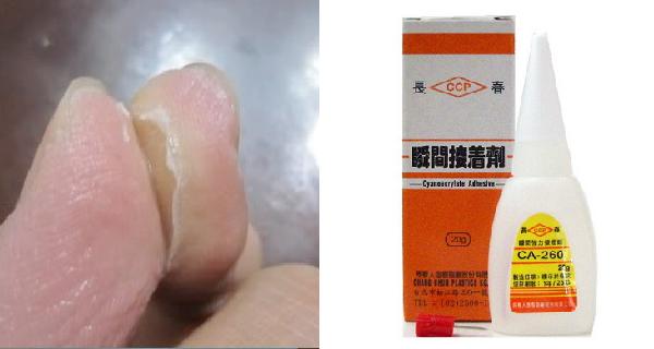 被三秒膠黏到？手都快扯破皮了還是沒扯開...終於有救星了