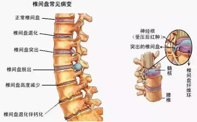 3分鐘2個小動作，腰疼、腿腳麻不再反覆，勝過單吃止疼藥~