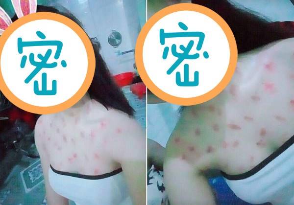 少女白皙雪乳種滿「草莓」　網諷「沒爆血管」？