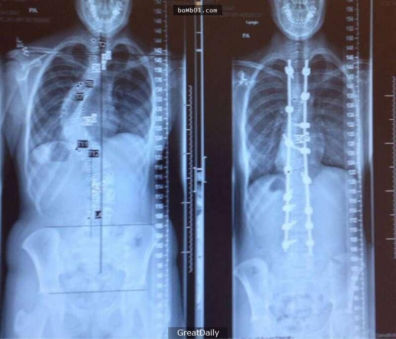 18張你現在不看 就一輩子也沒辦法看到了的一系列超震撼照片！