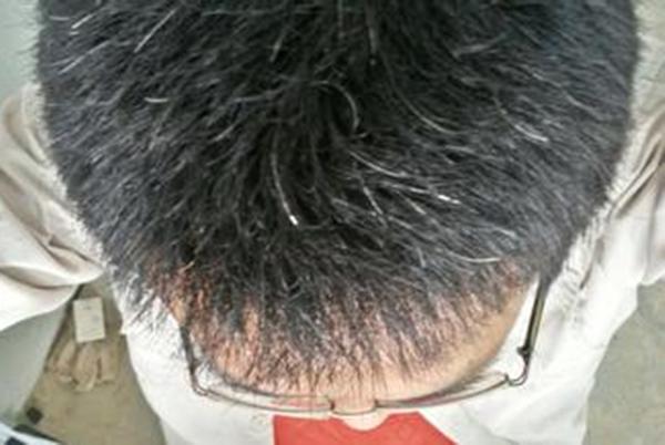 還沒老為何頭髮開始變白？很可能是你身體缺乏「這些營養素」，要對症下藥才能改善！