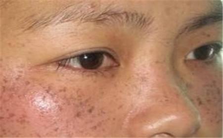 夏季正是排毒時，3大症狀說明你「中毒已深」，輕鬆排毒只需3件事