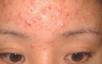夏季正是排毒時，3大症狀說明你「中毒已深」，輕鬆排毒只需3件事