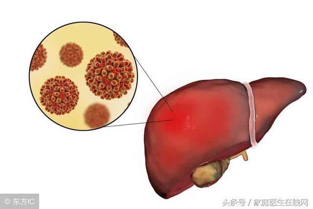 如果身體有這5個「感受」，下面就要和肝病作鬥爭了