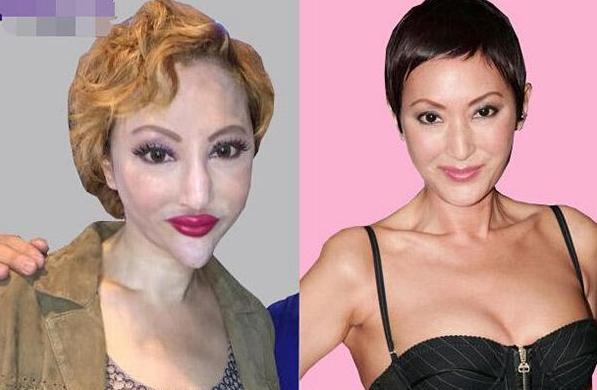 整容失敗的5大美女明星，真是可惜了