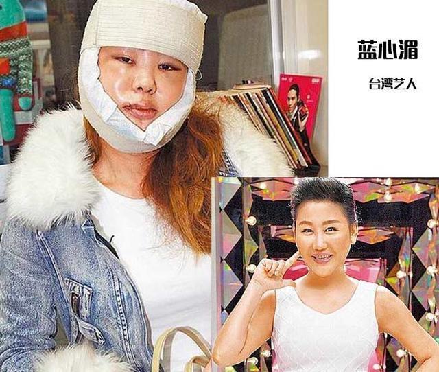 她為美整容13年，認了「8個乾兒子」，身家3億至今還沒有結婚！