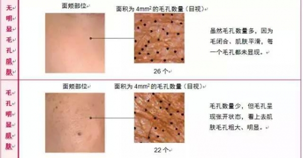 女人一定要勤保養才會更美麗，「7天」改善毛孔粗大問題