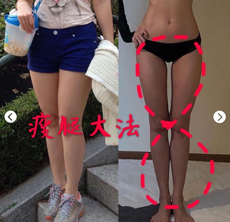 肉不再摩擦摩擦！　「大腿跟部」5招簡單運動這樣瘦 