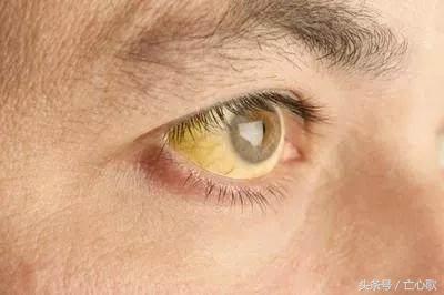 它是肝毒的「解毒王」, 每天吃一點，肝炎、肝硬化不攻自破