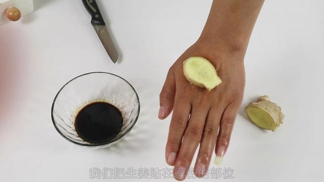不小心被燙傷怎麼辦？別慌，教你一招，快速止痛不留疤  