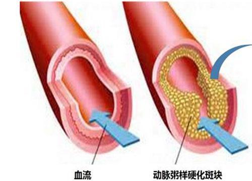 雞蛋吃多的壞處竟然這麼多，每天吃幾個雞蛋最合適？