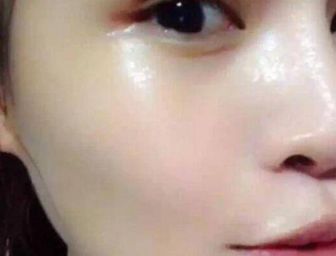 「它」是斑點皺紋的剋星，米醋加點它，老年斑、妊娠斑、雀斑、青春痘不見了好神奇